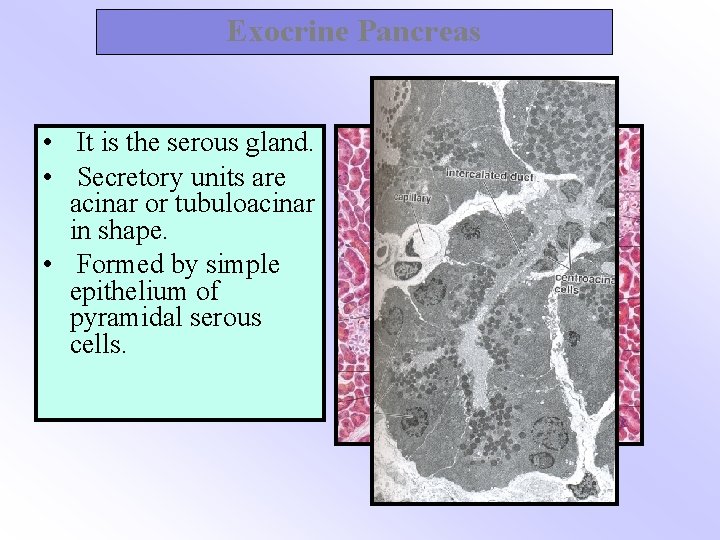 Exocrine Pancreas • It is the serous gland. • Secretory units are acinar or