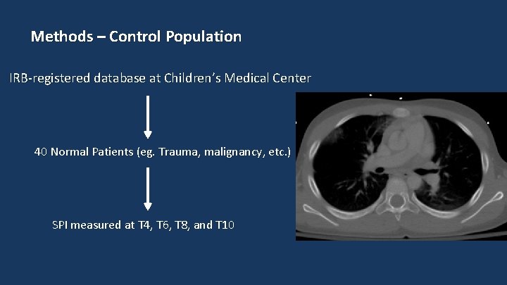 Methods – Control Population IRB-registered database at Children’s Medical Center 40 Normal Patients (eg.