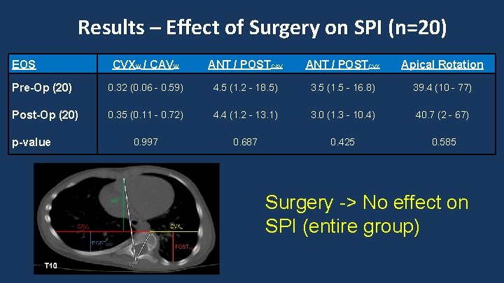Results – Effect of Surgery on SPI (n=20) EOS CVXW / CAVW ANT /