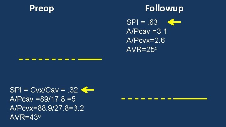 Preop Followup SPI =. 63 A/Pcav =3. 1 A/Pcvx=2. 6 AVR=25 o SPI =
