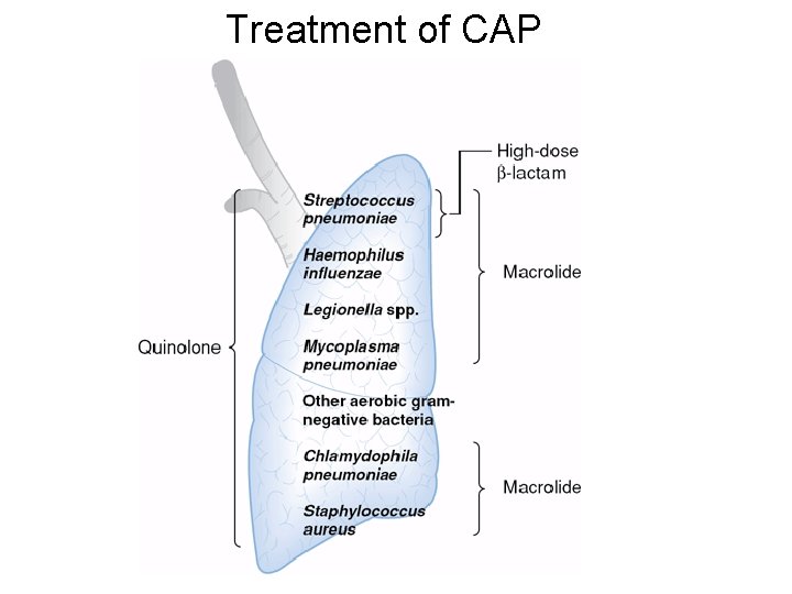 Treatment of CAP 