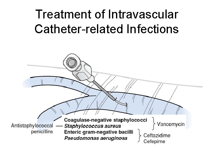 Treatment of Intravascular Catheter-related Infections 