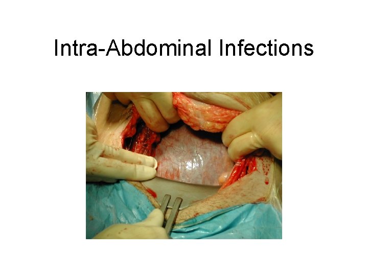 Intra-Abdominal Infections 