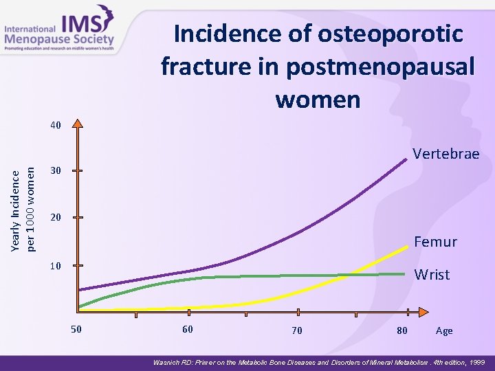 Incidence of osteoporotic fracture in postmenopausal women 40 Yearly Incidence per 1000 women Vertebrae Incidence of osteoporotic fracture in postmenopausal women 40 Yearly Incidence per 1000 women Vertebrae