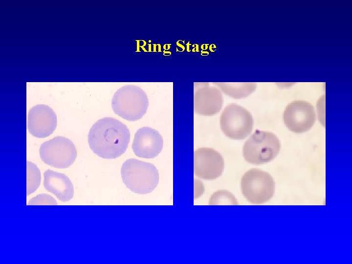 Ring Stage Ring Stage