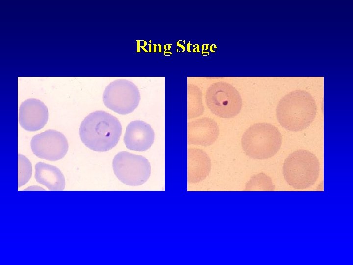 Ring Stage Ring Stage