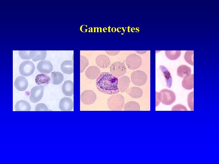 Gametocytes Gametocytes