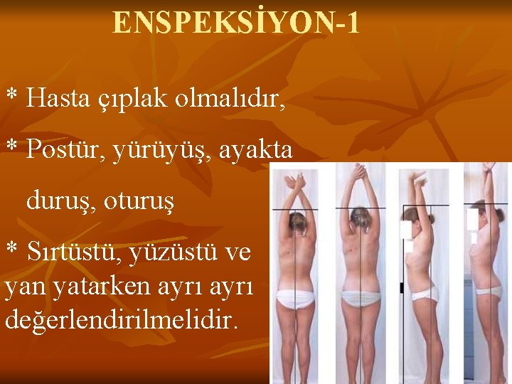 ENSPEKSİYON-1 * Hasta çıplak olmalıdır, * Postür, yürüyüş, ayakta duruş, oturuş * Sırtüstü, yüzüstü ENSPEKSİYON-1 * Hasta çıplak olmalıdır, * Postür, yürüyüş, ayakta duruş, oturuş * Sırtüstü, yüzüstü