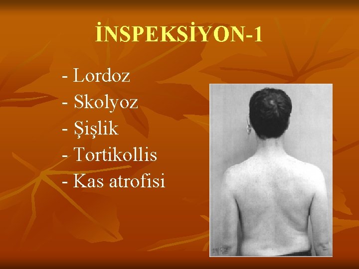 İNSPEKSİYON-1 - Lordoz - Skolyoz - Şişlik - Tortikollis - Kas atrofisi İNSPEKSİYON-1 - Lordoz - Skolyoz - Şişlik - Tortikollis - Kas atrofisi