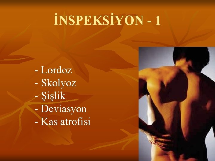 İNSPEKSİYON - 1 - Lordoz - Skolyoz - Şişlik - Deviasyon - Kas atrofisi İNSPEKSİYON - 1 - Lordoz - Skolyoz - Şişlik - Deviasyon - Kas atrofisi