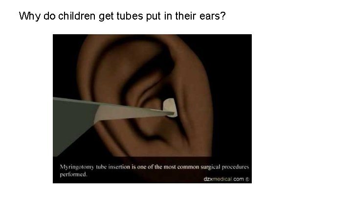 Why do children get tubes put in their ears? 