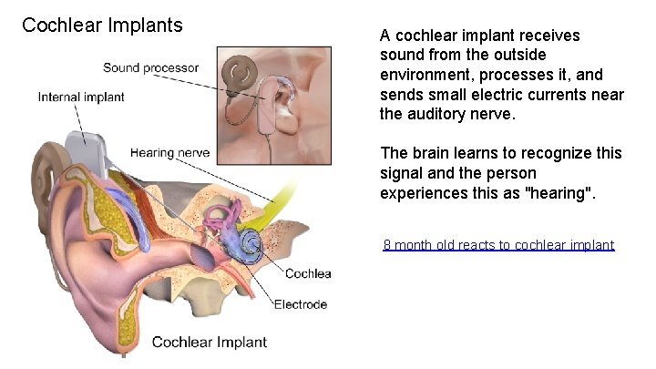 Cochlear Implants A cochlear implant receives sound from the outside environment, processes it, and