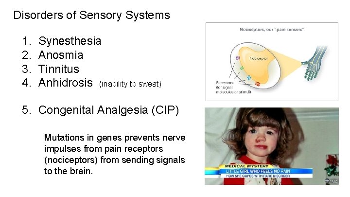 Disorders of Sensory Systems 1. Synesthesia 2. Anosmia 3. Tinnitus 4. Anhidrosis (inability to