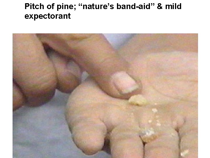 Pitch of pine; “nature’s band-aid” & mild expectorant 