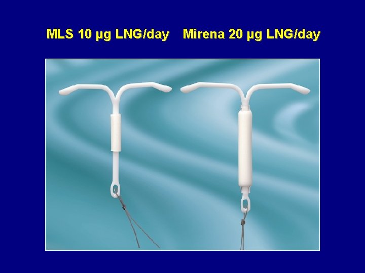 MLS 10 µg LNG/day Mirena 20 µg LNG/day 