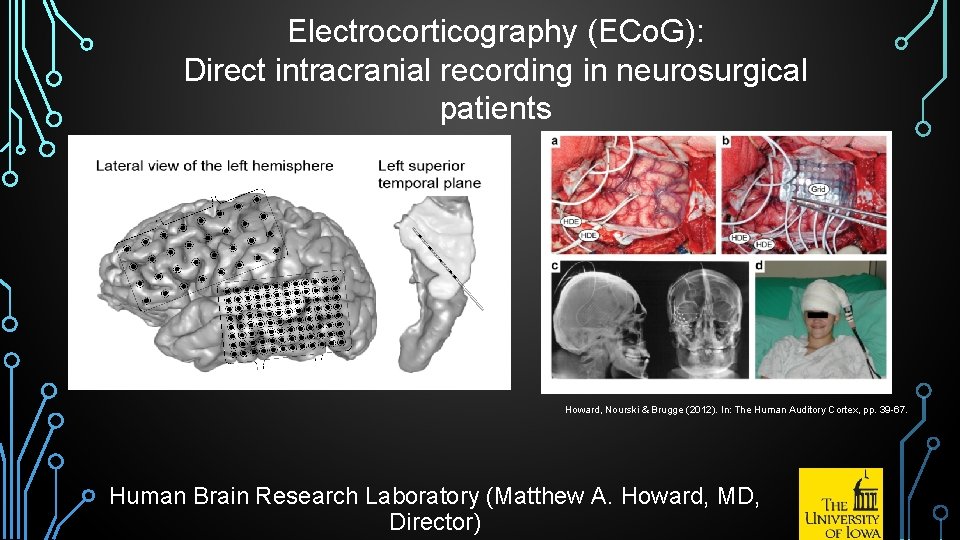 Electrocorticography (ECo. G): Direct intracranial recording in neurosurgical patients Howard, Nourski & Brugge (2012).