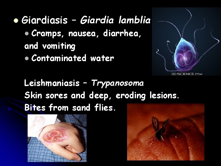 l Giardiasis – Giardia lamblia Cramps, nausea, diarrhea, and vomiting l Contaminated water l