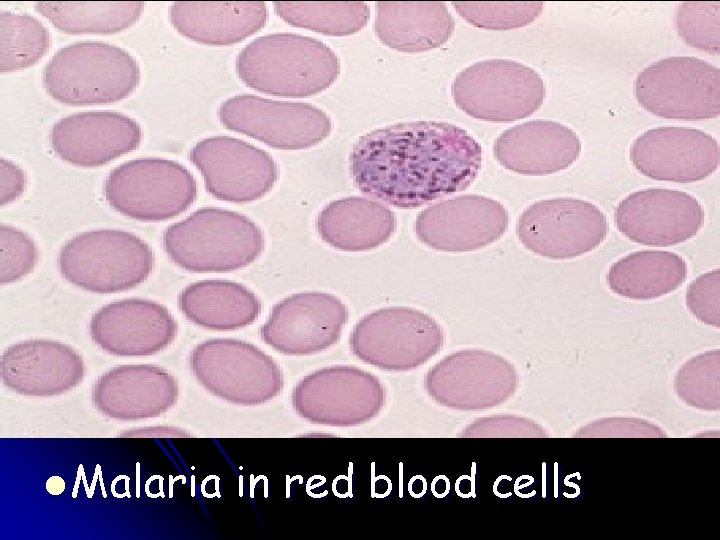 l Malaria in red blood cells 