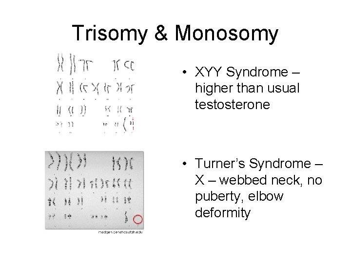 Trisomy & Monosomy • XYY Syndrome – higher than usual testosterone • Turner’s Syndrome