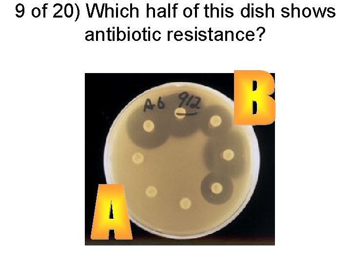 9 of 20) Which half of this dish shows antibiotic resistance? 