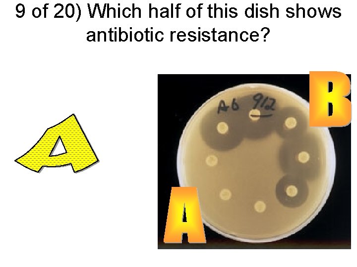 9 of 20) Which half of this dish shows antibiotic resistance? 