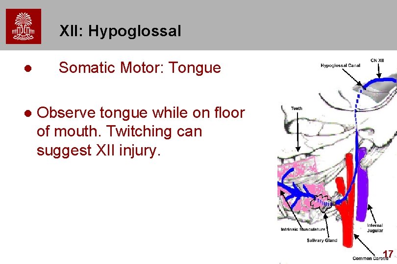 XII: Hypoglossal l Somatic Motor: Tongue l Observe tongue while on floor of mouth.