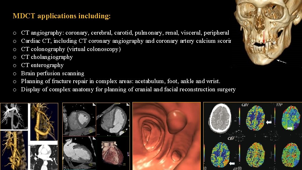 MDCT applications including: CT angiography: coronary, cerebral, carotid, pulmonary, renal, visceral, peripheral Cardiac CT,