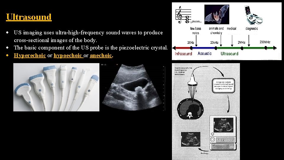 Ultrasound US imaging uses ultra-high-frequency sound waves to produce cross-sectional images of the body.