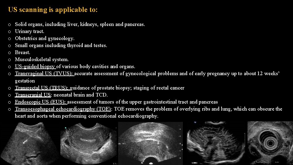 US scanning is applicable to: o o o Solid organs, including liver, kidneys, spleen