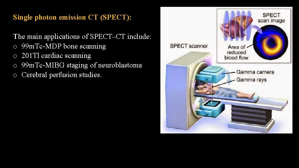 Single photon emission CT (SPECT): The main applications of SPECT–CT include: o 99 m.