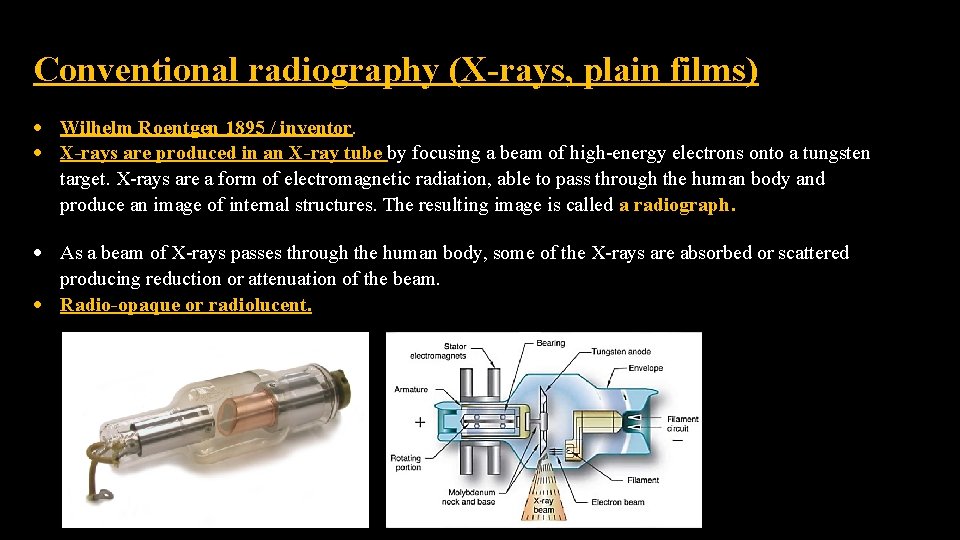 Conventional radiography (X-rays, plain films) Wilhelm Roentgen 1895 / inventor. X-rays are produced in