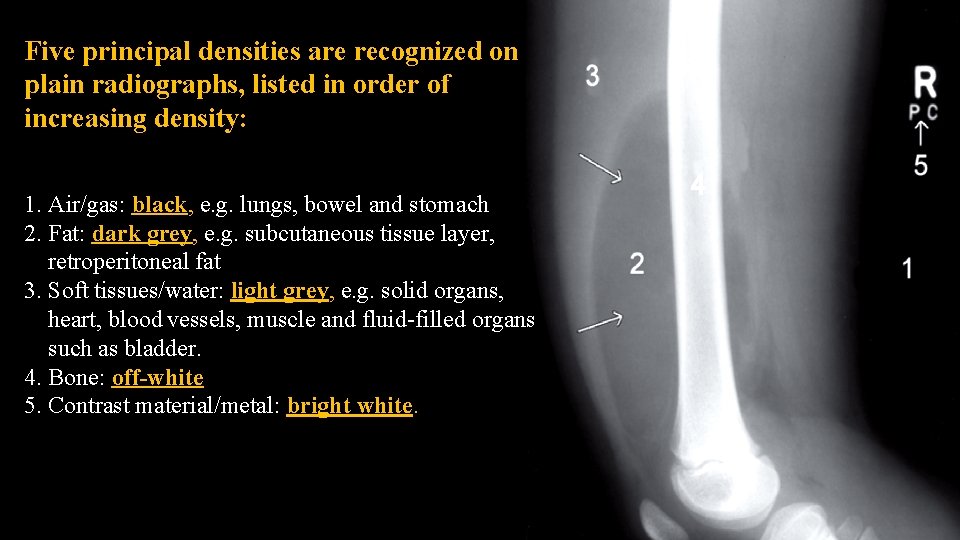 Five principal densities are recognized on plain radiographs, listed in order of increasing density: