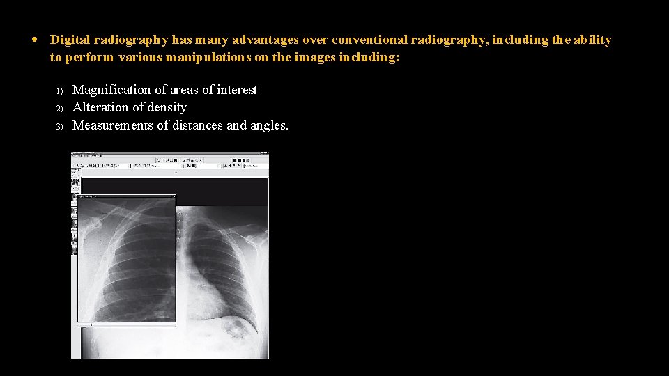  Digital radiography has many advantages over conventional radiography, including the ability to perform