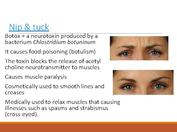 Nip & tuck Botox = a neurotoxin produced by a bacterium Chlostridium botuninum It