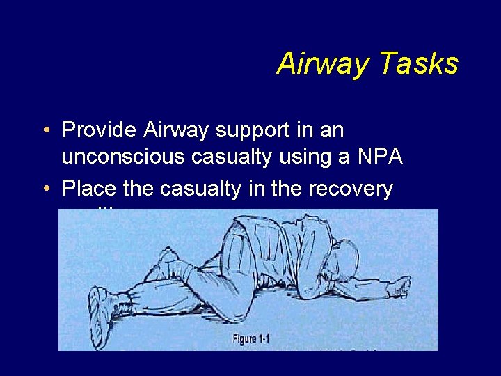 Airway Tasks • Provide Airway support in an unconscious casualty using a NPA •