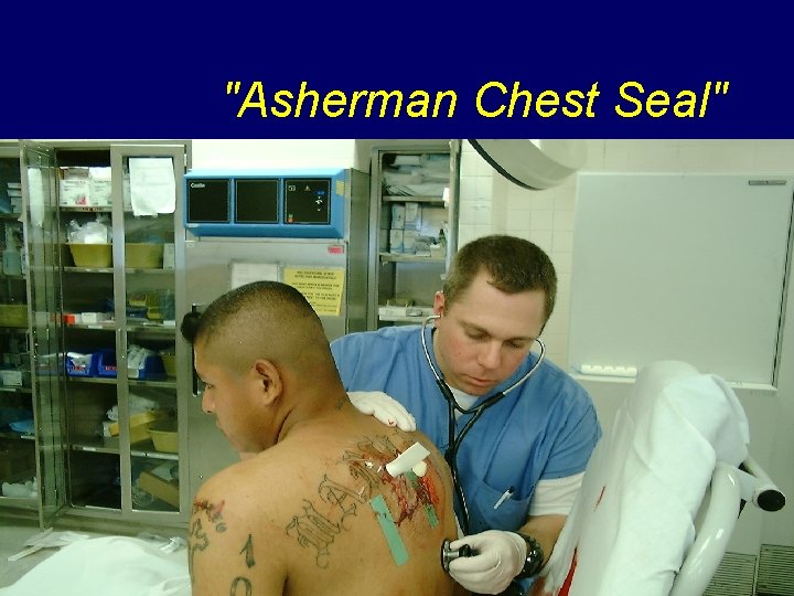 "Asherman Chest Seal" 