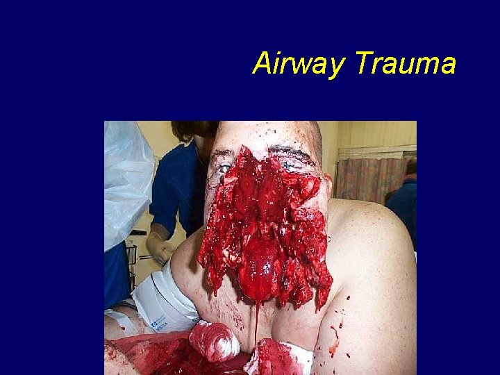 Airway Trauma 