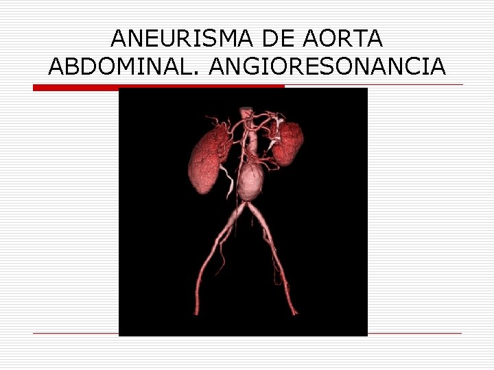 ANEURISMA DE AORTA ABDOMINAL. ANGIORESONANCIA 