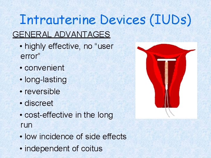 Intrauterine Devices (IUDs) GENERAL ADVANTAGES • highly effective, no “user error” • convenient •