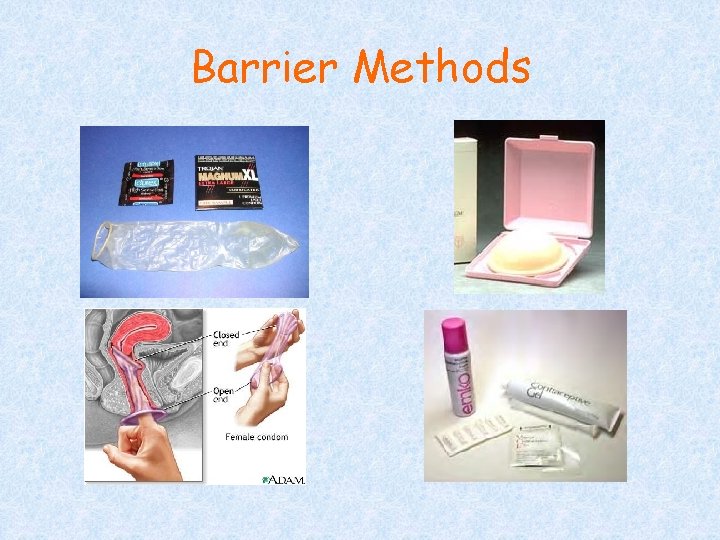 Barrier Methods 
