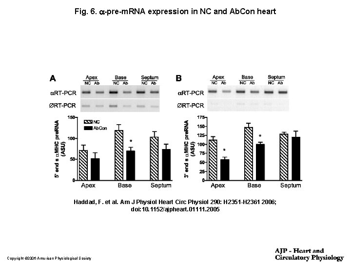 Fig. 6. a-pre-m. RNA expression in NC and Ab. Con heart Haddad, F. et