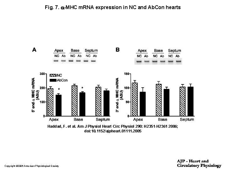 Fig. 7. a-MHC m. RNA expression in NC and Ab. Con hearts Haddad, F.