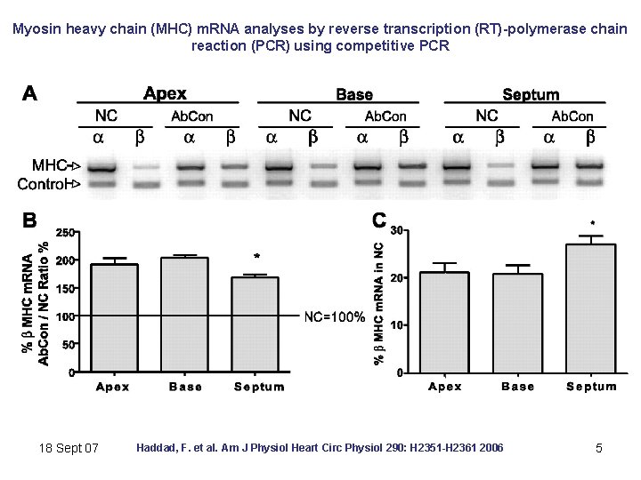 Myosin heavy chain (MHC) m. RNA analyses by reverse transcription (RT)-polymerase chain reaction (PCR)