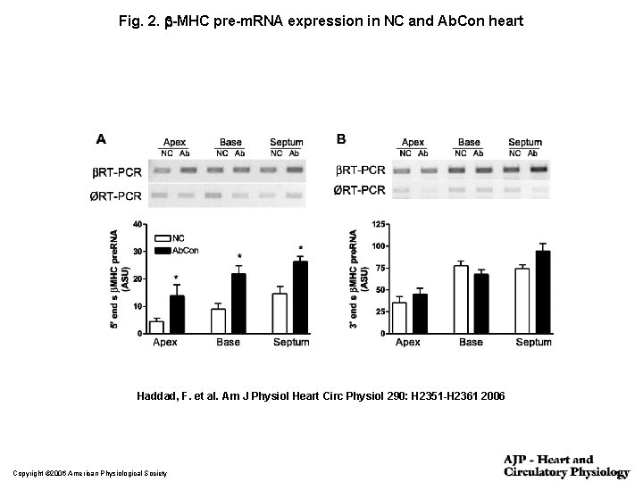 Fig. 2. b-MHC pre-m. RNA expression in NC and Ab. Con heart Haddad, F.