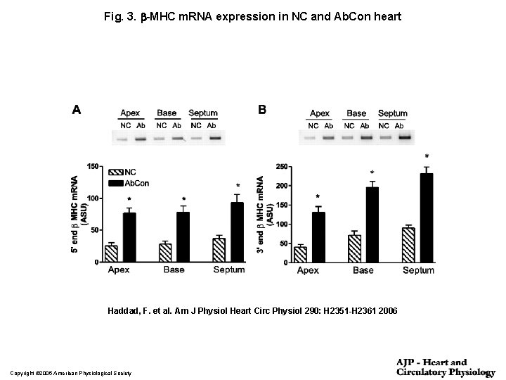 Fig. 3. b-MHC m. RNA expression in NC and Ab. Con heart Haddad, F.