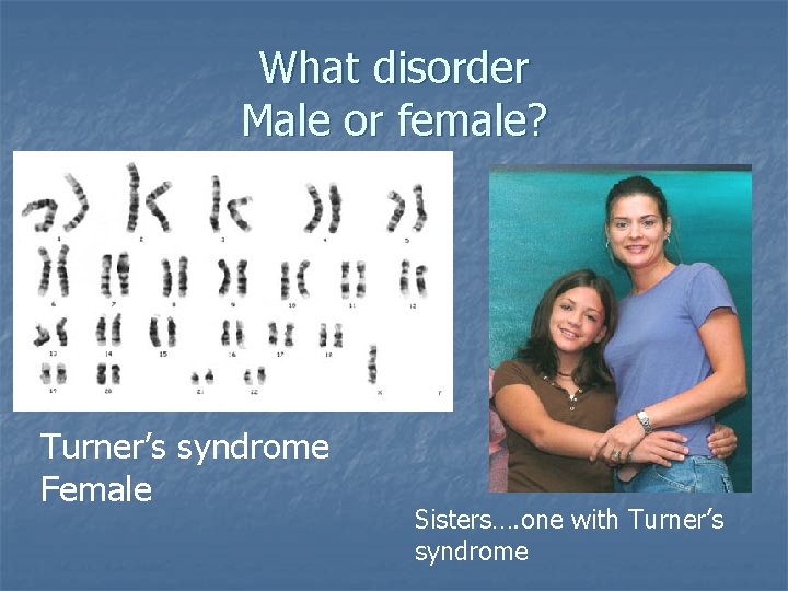 What disorder Male or female? Turner’s syndrome Female Sisters…. one with Turner’s syndrome 