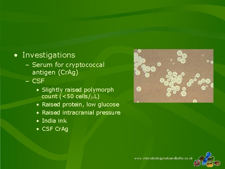  • Investigations – Serum for cryptococcal antigen (Cr. Ag) – CSF • Slightly