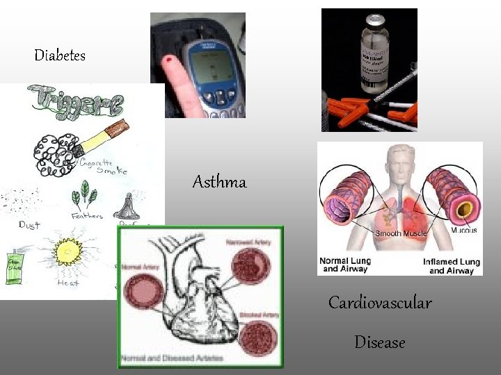 Diabetes Asthma Cardiovascular Disease 