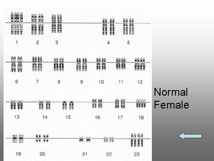 Normal Female Normal Female