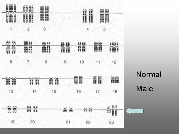 Normal Male 